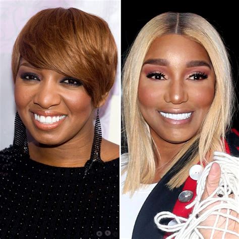 NeNe Leakes Plastic Surgery: Before, After Photos